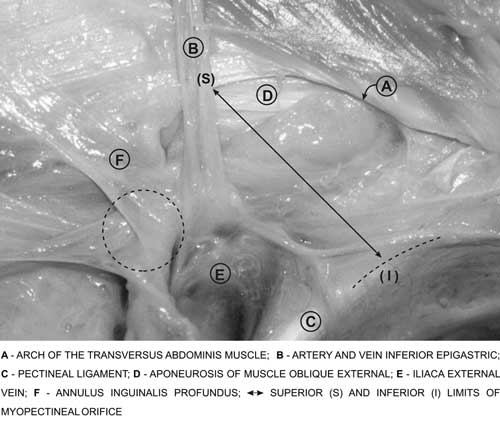 Arquivos hernia inguinal - Constancio e Moser